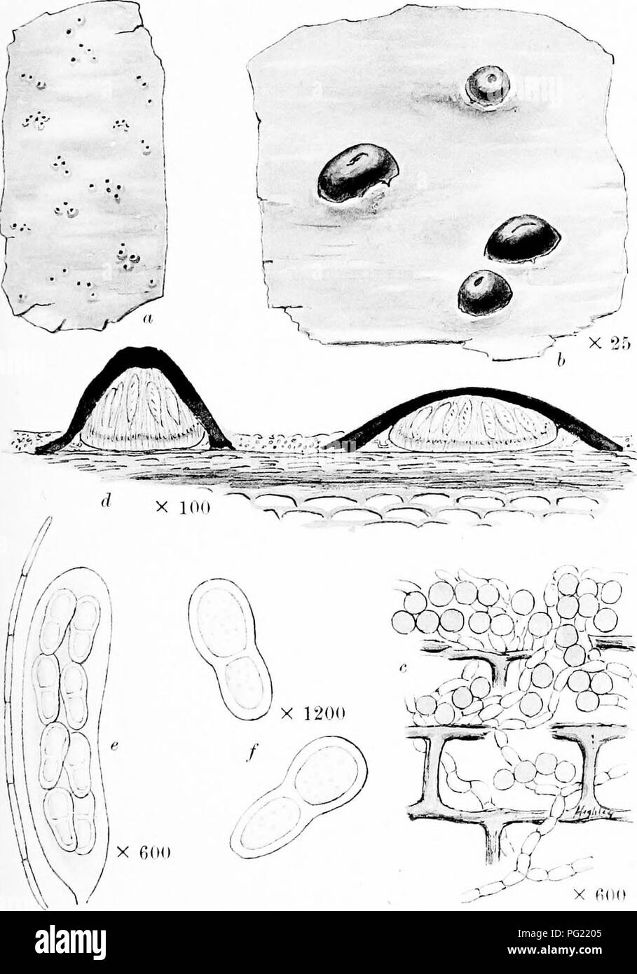 . A monograph of lichens found in Britain; being a descriptive catalogue of the species in the herbarium of the British Museum. Lichens. Plate 49. ARTHOPYKENIA PALLAX Arn. a Whole plant, h. Portion of thallus and peritheeia. c. Vertical section of thallus. d. Vertical section of peritheeia. e. Ascus and paraphysis. /. Spores.. Please note that these images are extracted from scanned page images that may have been digitally enhanced for readability - coloration and appearance of these illustrations may not perfectly resemble the original work.. British Museum (Natural History). Dept. of Botany; Stock Photo