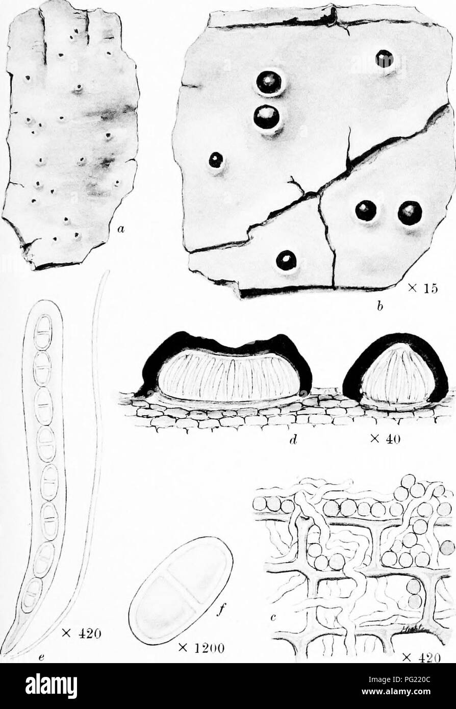 . A monograph of lichens found in Britain; being a descriptive catalogue of the species in the herbarium of the British Museum. Lichens. Plate 48. ACROCORDIA GEMMATA Koerb. a. Whole plant, b. Portion of thallus and perithecia. c. Vertical section of tballus. d. Vertical section of peritlnecia. e. Ascus and paraphyais. /. Spore.. Please note that these images are extracted from scanned page images that may have been digitally enhanced for readability - coloration and appearance of these illustrations may not perfectly resemble the original work.. British Museum (Natural History). Dept. of Botan Stock Photo