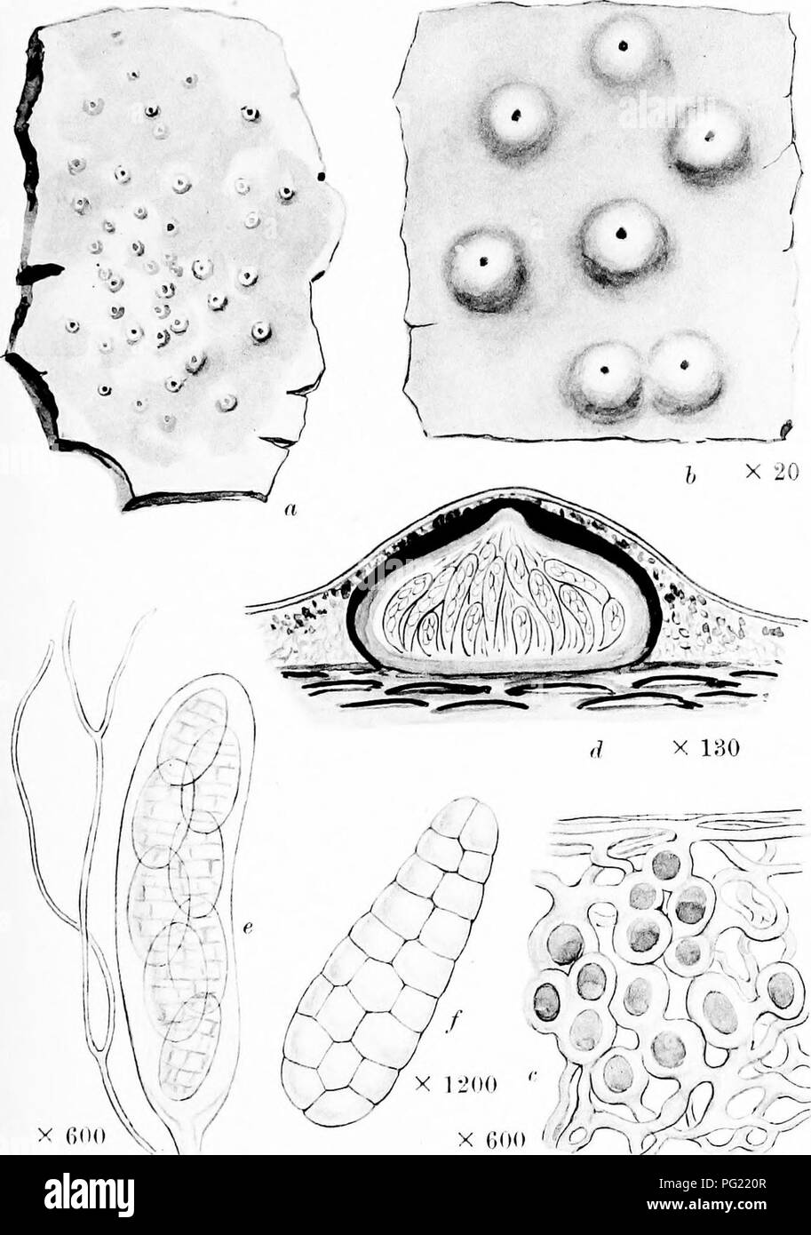 . A monograph of lichens found in Britain; being a descriptive catalogue of the species in the herbarium of the British Museum. Lichens. Plate 46. X fidO , MICROGLAENA MODESTA A. L. Sni. a Whole plant, b. Portion of thallns siiul perithecia. c. Vertical pectioii of thallus. d. Vertical section of perithecium. e. Ascus and paraphysis. /. Spore.. Please note that these images are extracted from scanned page images that may have been digitally enhanced for readability - coloration and appearance of these illustrations may not perfectly resemble the original work.. British Museum (Natural History Stock Photo