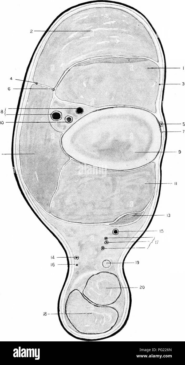 . The surgical anatomy of the horse ... Horses. 12-. Plate VIII.—Transverse Section of Right Hind Limb Through Seat of Pos'i-erior Tibial Neurectomy. I. Flexor Metatarsi. 2. Extensor pedis. 3 *-: 7. Branches of internal saphena nerve. 4. Musculo-cutaneous nerve. 5. Anterior root of internal saphena vein. 6. Anterior tibial nerve. 8. Anterior tibial veins. g. Tibia. 10. Anterior tibial artery. II. Perforans muscle. 12. Peroneus muscle. 13. Tendon of flexor accessorius. 14. External saphena vein. 15. Posterior root of internal saphena vein. 16. External saphena nerve. 17. Posterior tibial arter Stock Photo