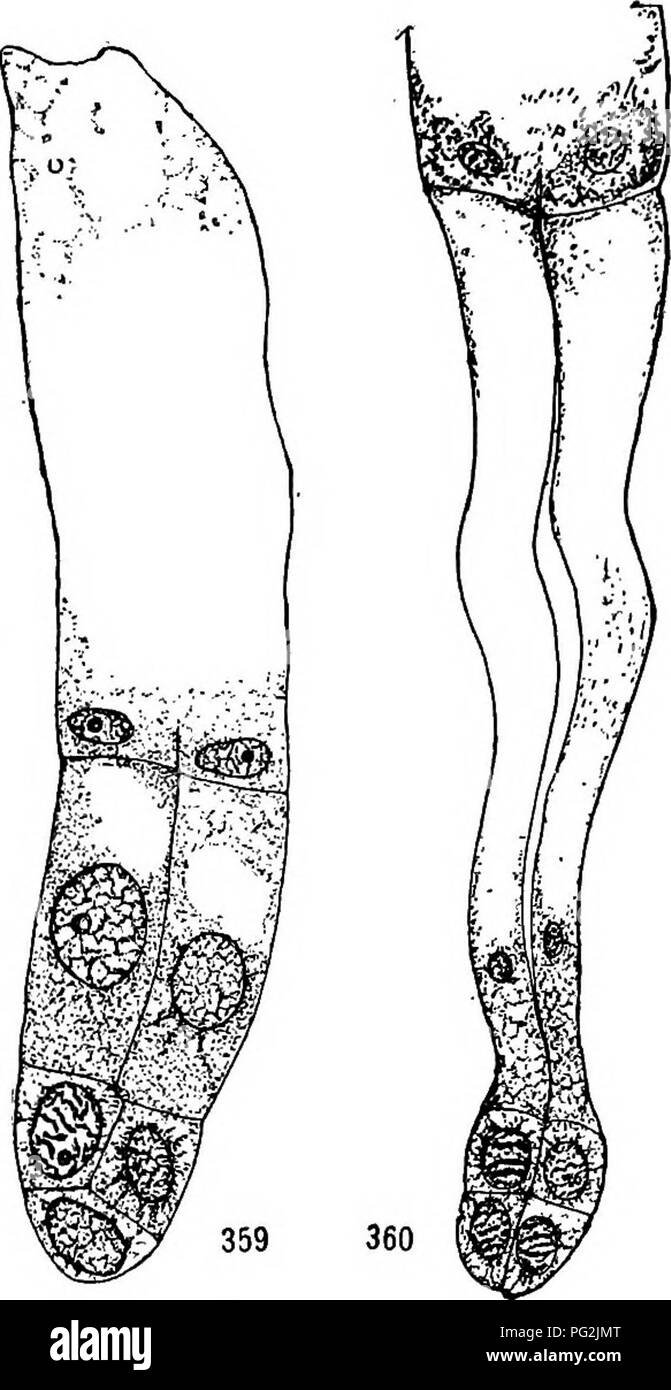 Diagram from 'Morphology of Gymnosperms' showing early embryonic stages ...