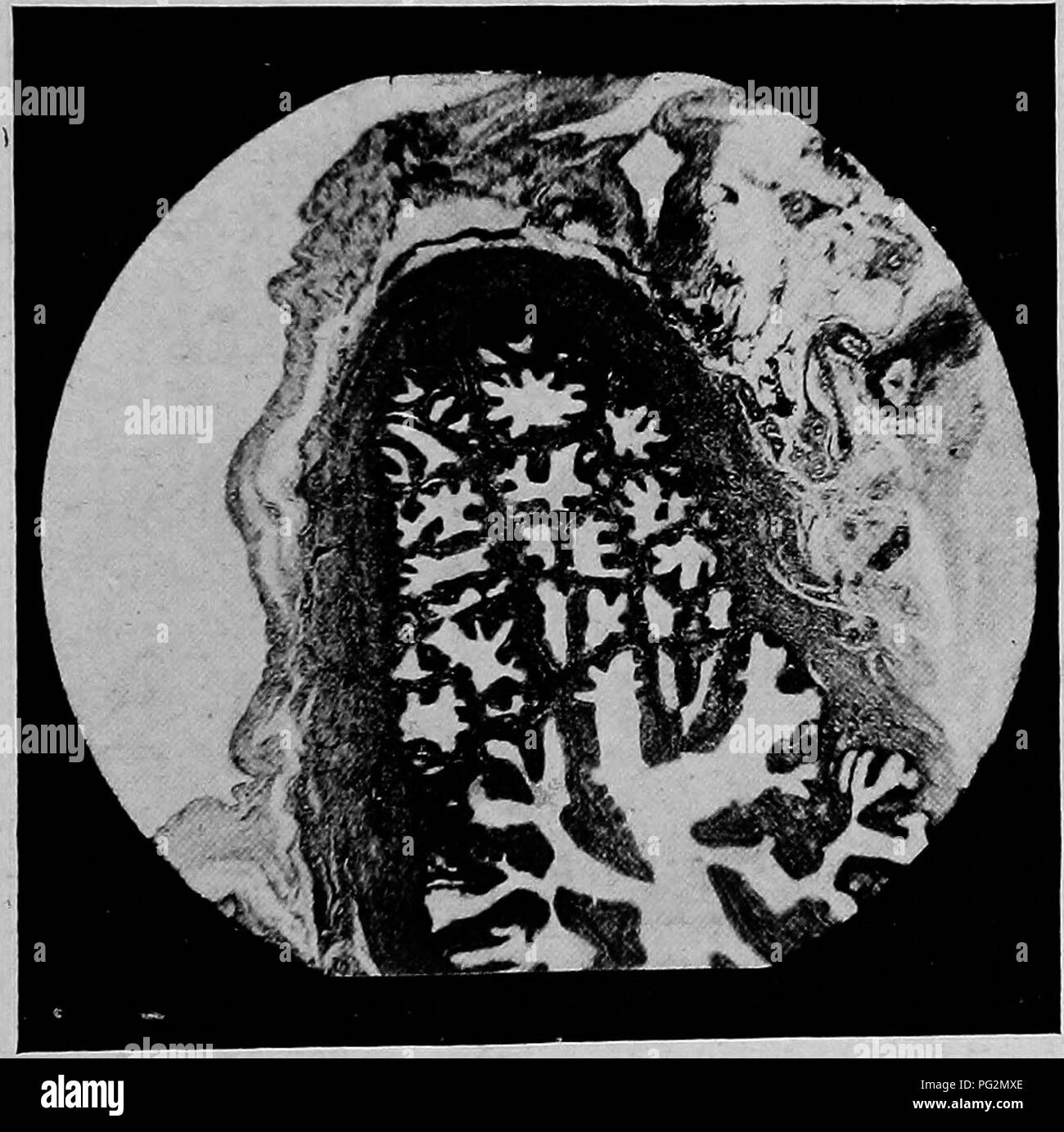 . The diseases of the genital organs of domestic animals. Veterinary medicine. Salpingitis 433 the ampulla, however, they increase in number and height, with the formation of numerous secondary folds, so that at the ampulla the otherwise broad lumen becomes almost oc- cluded. At the fimbriated end, the folds widen and are con- tinued out on the free ends of the fimbriae, forming ridges which branch freely, giving the pavilion a more or less honeycombed appearance. Not infrequently one finds the folds ramifying elaborately, particularly at their bases, forming cavities lined by a sort of flatte Stock Photo