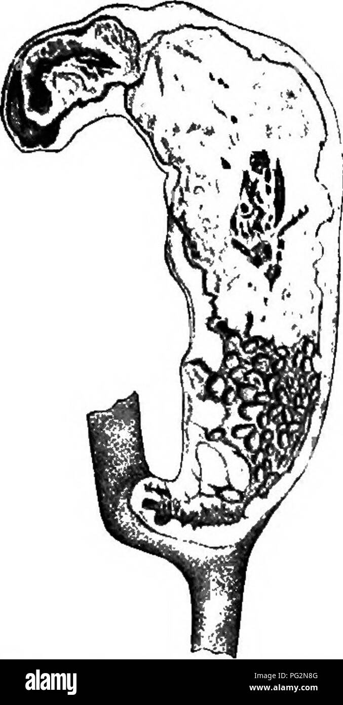. The pathology and differential diagnosis of infectious diseases of animals : prepared for students and practitioners of veterinary medicine . Veterinary medicine; Communicable diseases in animals. INFECTIOUS ENTERO-HEPATITIS 321. Fig. 72. diseased cecum showing the ulcer- ated mucosa. and they bind it to the other cecum or to the intestine or attach it to the abdominal wall. In these stages, the microparasite is not found. It seems to have done its work by destroying the mucous membrane and to have left the field for miscellaneous bacteria. Other portions of the digestive tract are not affec Stock Photo