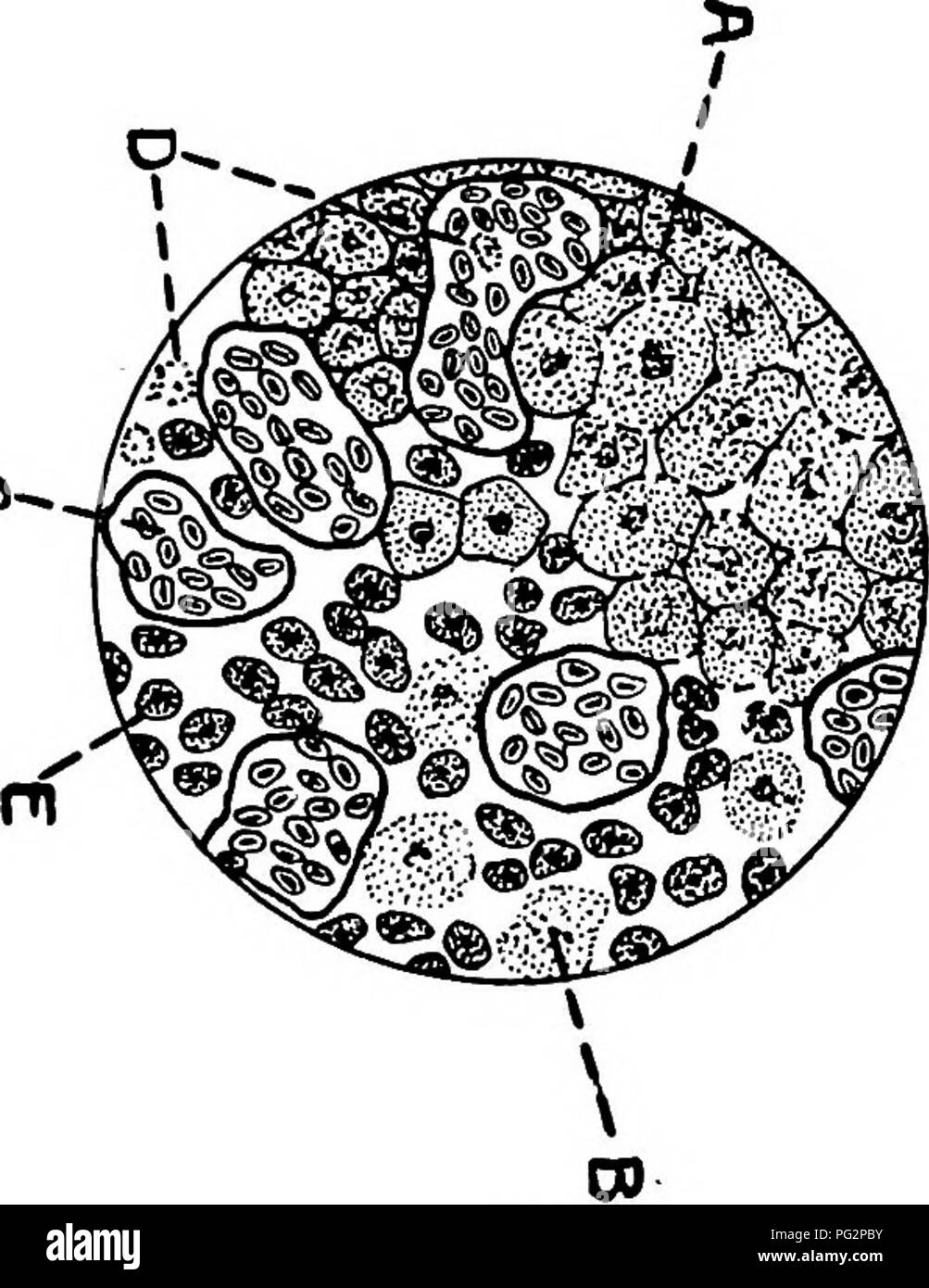 . Animal parasites and parasitic diseases . Domestic animals; Veterinary medicine. PARASITOLOGY. 219 O-. Fig. 81. Fig. 81.—A section of liver, Fig. 80, from the area marked by b, magnified 900 diameters; stained with hema- toxylin and eosin; a, liver cells showing cloudy swelling; b, liver cells undergoing disintegration; c, congested blood vessels, passive congestion; d, white blood cells (eosino- philes) so abundant in Che blood and diseased tissues in this disease; e, the protozoon causing t)he disease.—From Kaupp's Diseases of Poultry,. Please note that these images are extracted from scan Stock Photo