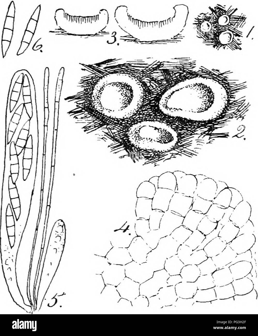 . British fungus-flora. A classified text-book of mycology. Fungi. iL^SSEEA, 403 Agreeing with Humaria in size, habit, and structure of the ascophore, but differing in the septate spores. Masseea quisquilarum. Sacc., Syll., viii. n. 2017. Ascophores gregarious, sessile, at first globose and closed, then expanding and becoming concave or plane, fleshy, glabrous, clear yellow, 2-3 mm. across; excipulum paren-. Masieea quiequUarum, Sacc.—Fig. 1, nat. size;—Fig. 2, ascophorcB, • slightly X ;—Fig. 3, sectibns of same, slightly x ;—Fig. 4, portion of excipulum x 400;—Fig. 5, asci and paraphyses, x 4 Stock Photo
