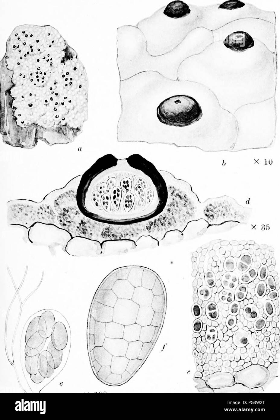 . A monograph of lichens found in Britain; being a descriptive catalogue of the species in the herbarium of the British Museum. Lichens. Plate 43. X 600 X ]:-i5 X fioo POLYBLASTIA THELEODES Th. Fr. a Wl.ole plant, b. Portion of thallus and perithecia. c. Vertical section of thallus d. Vertical section of peritfcLOcium. e. Ascus and paraphysis. /. Spore.. Please note that these images are extracted from scanned page images that may have been digitally enhanced for readability - coloration and appearance of these illustrations may not perfectly resemble the original work.. British Museum (Natura Stock Photo