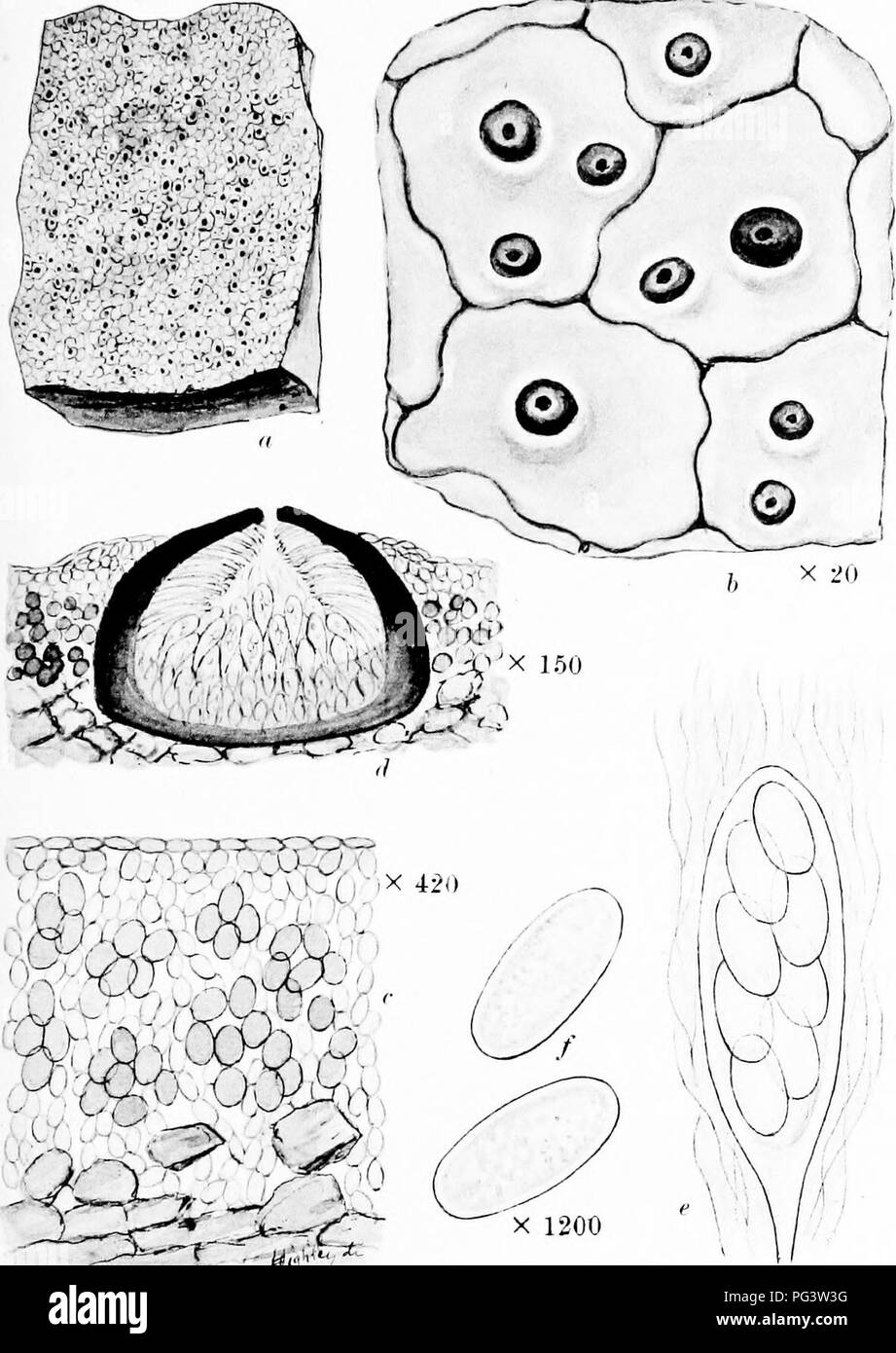 . A monograph of lichens found in Britain; being a descriptive catalogue of the species in the herbarium of the British Museum. Lichens. Plate 41. W.ti-' X 600 VERRUCARIA PAPILLOSA Aoh. a. Whole plant, h. Portion of thallus and peritbeoia. c Vertical section of thallus. d. Vertical section of peritheoium. e. Ascus and paraphyses. /. Spores.. Please note that these images are extracted from scanned page images that may have been digitally enhanced for readability - coloration and appearance of these illustrations may not perfectly resemble the original work.. British Museum (Natural History). D Stock Photo