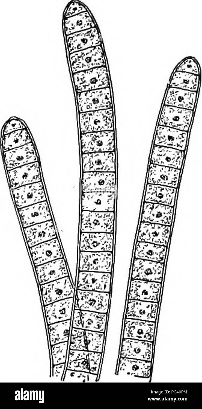 Oscillatoria Bacteria Labeled