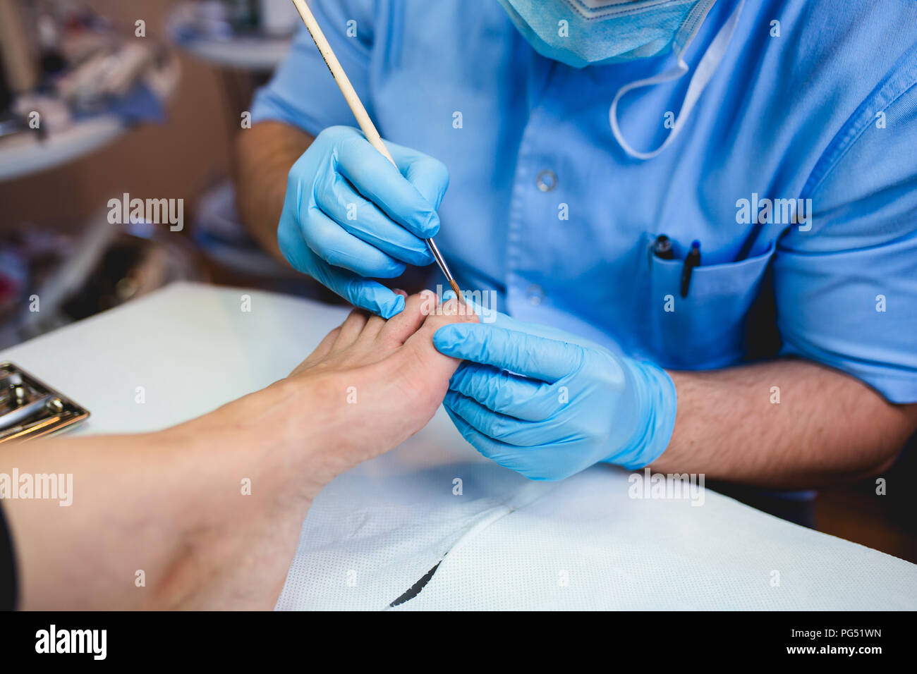 Toenail fungus treatment with foot laser at laser nail therapy clinic Stock Photo Alamy