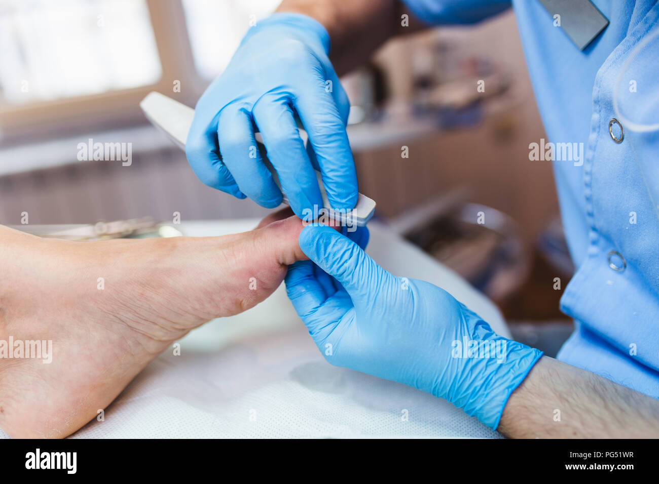 Toenail fungus treatment with foot laser at laser nail therapy clinic Stock Photo Alamy