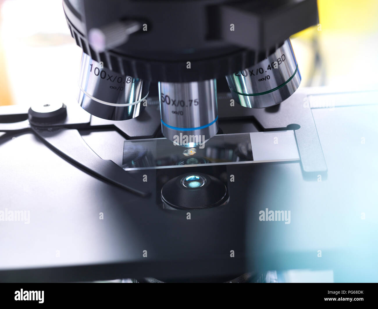 Biomedical Research, close-up of a glass slide holding a specimen of human tissue, microscope Stock Photo