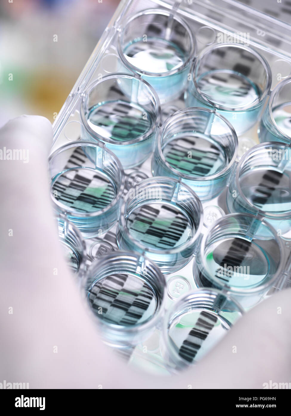 Research, Scientist holding a multi well plate and DNA gel