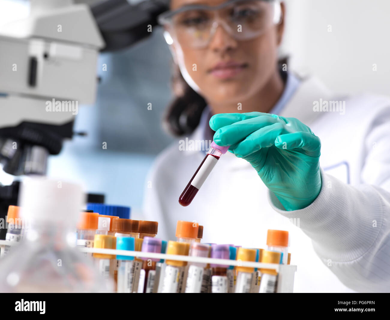 Feamle scientist preparing a blood sample for clinical testing in the laboratory Stock Photo