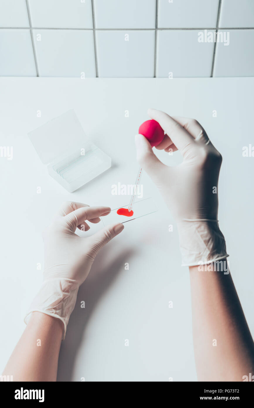 cropped shot of doctor pouring blood from pipette onto blood slide for