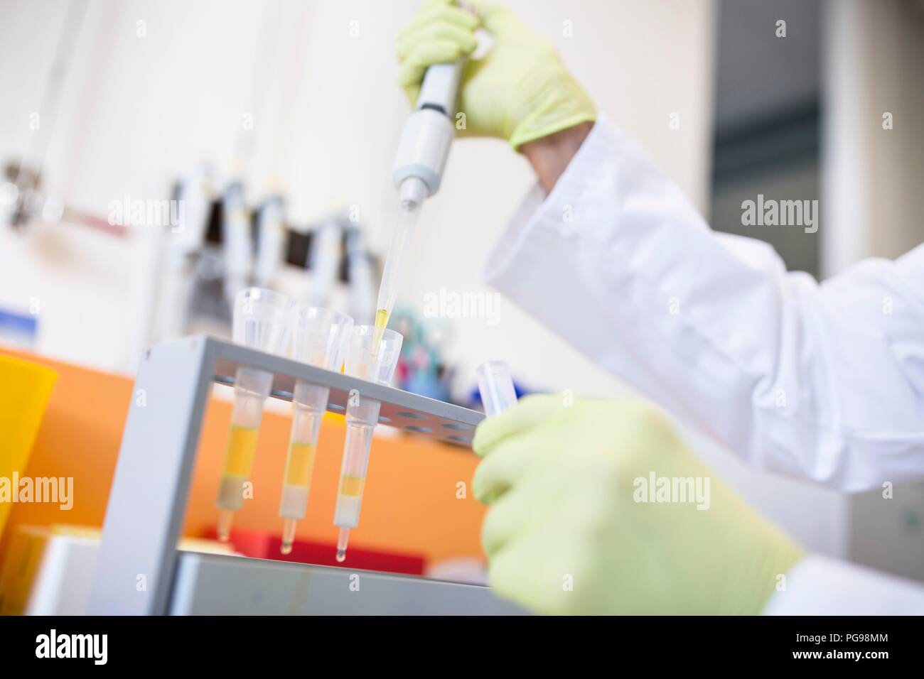 Technician pipetting samples into cartridges for solid phase extraction (SPE). SPE is used to separate biological compounds from a mixture for further analysis. Stock Photo