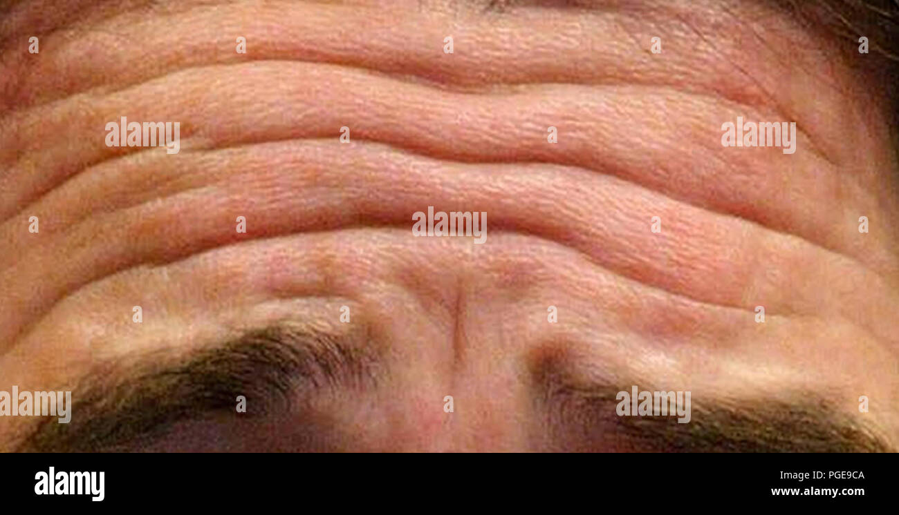 Forehead wrinkles High Resolution Stock Photography and Images - Alamy