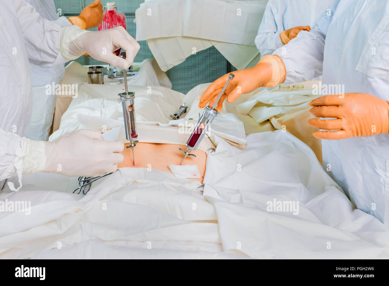 Bone Marrow Transplant High Resolution Stock Photography and Images Alamy