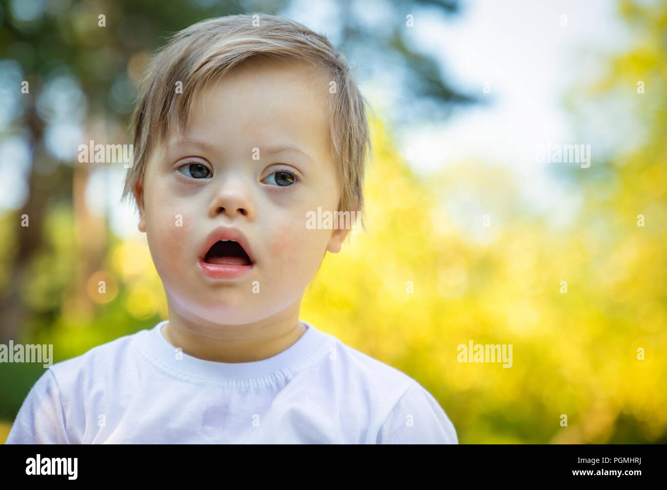 Portrait of Cute small boy with Down syndrome playing in summer day