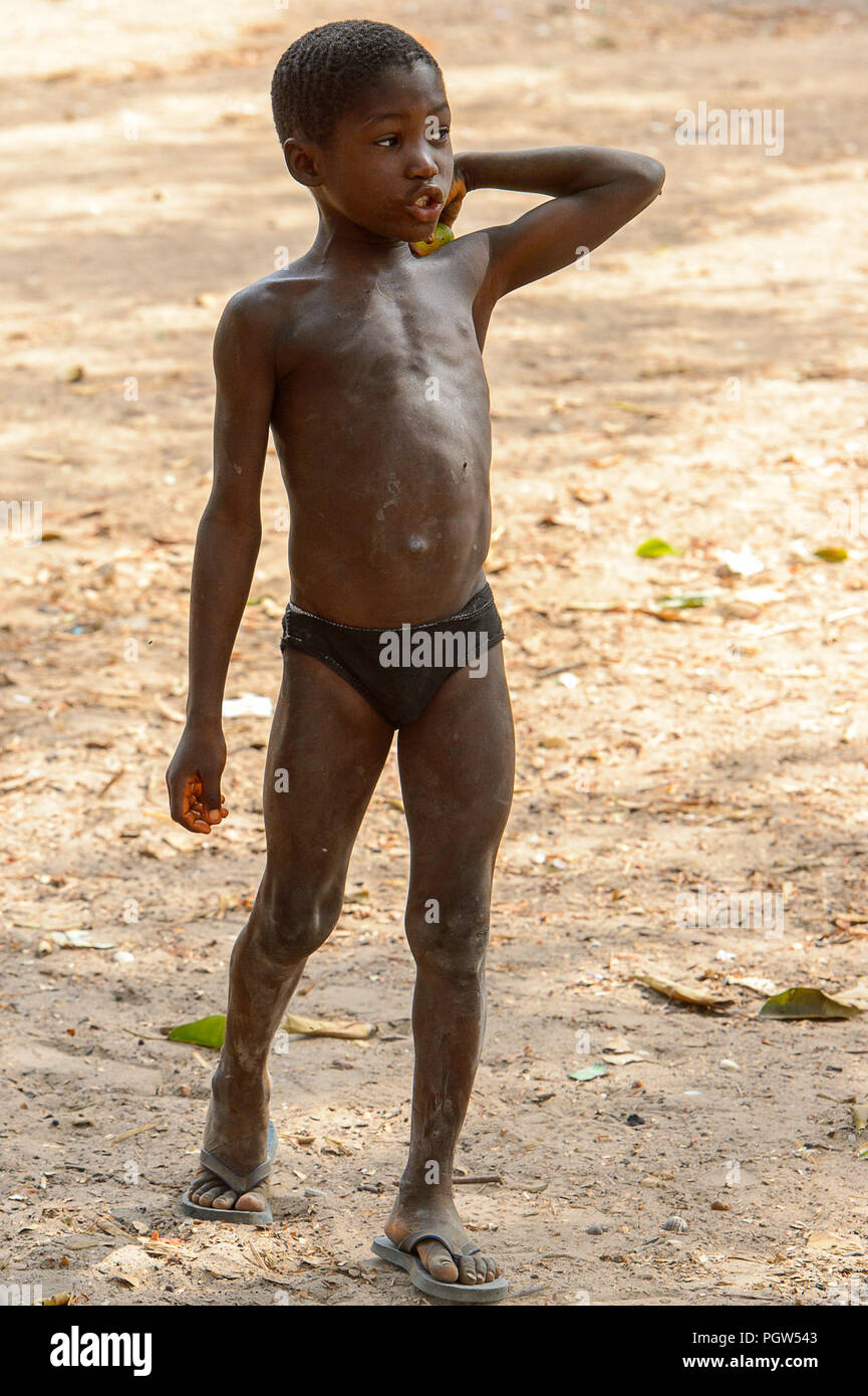 SOGA, GUINEA BISSAU - MAY 5, 2017: Unidentified local little boy scratches  his neck in a village of the Soga island. People in G.-Bissau still suffer  Stock Photo - Alamy