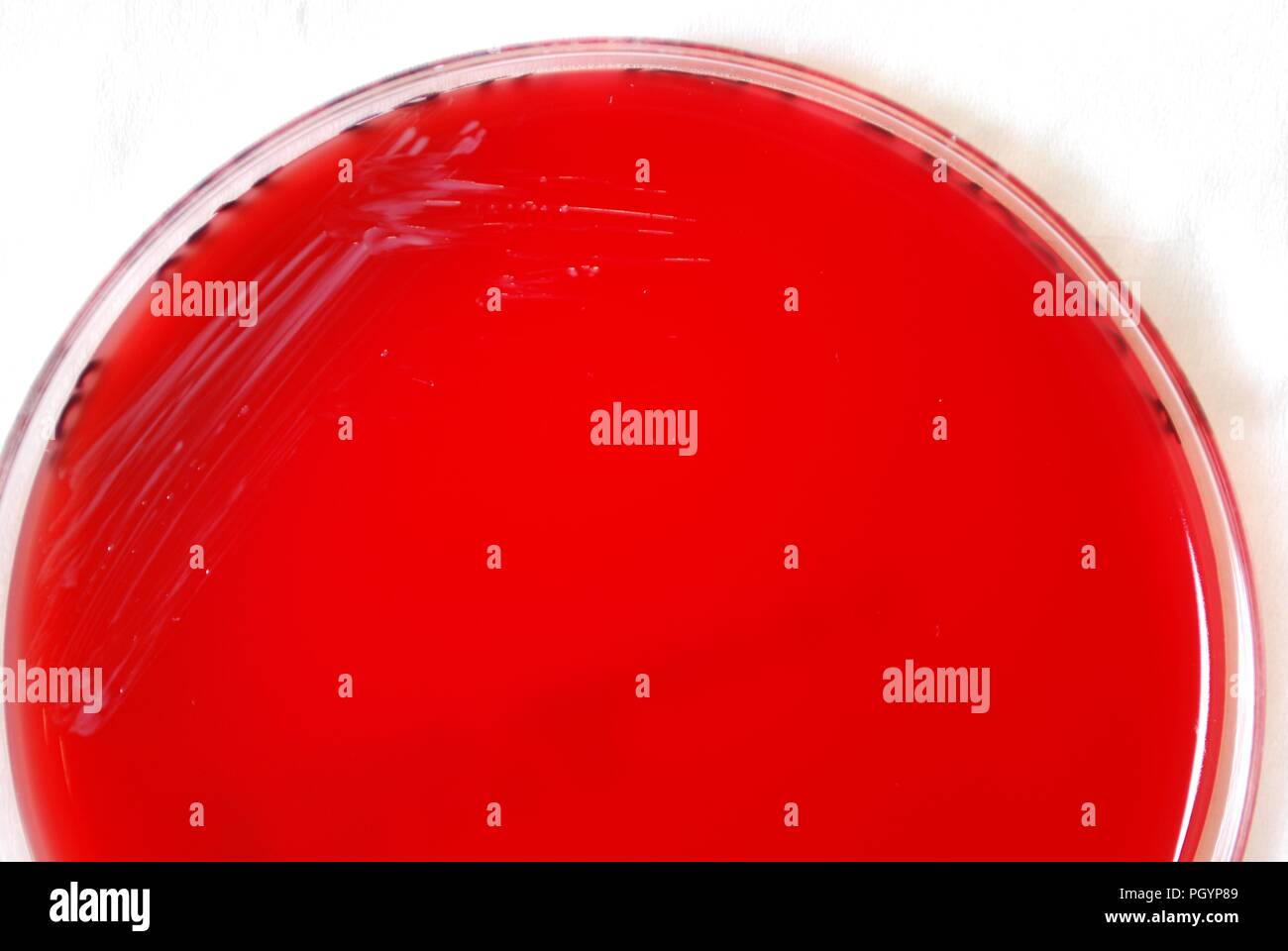 Close-up photograph of a petri dish containing a red-colored sample of Gram-negative Brucella abortus bacteria, grown in a CO2 incubator, on a medium of sheep's blood agar (SBA) for a 24 hour time period, at a temperature of 37 C, image courtesy CDC/Dr Todd Parker, Audra Marsh, 2010. () Stock Photo