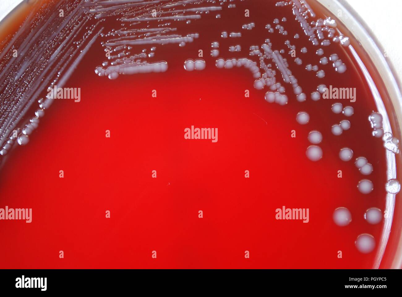 Colonial morphology of Gram-negative Yersinia pestis bacteria grown 72 hours on a medium of sheep's blood agar (SBA), 2010. Image courtesy Centers for Disease Control (CDC) / Dr Todd Parker, Audra Marsh. () Stock Photo