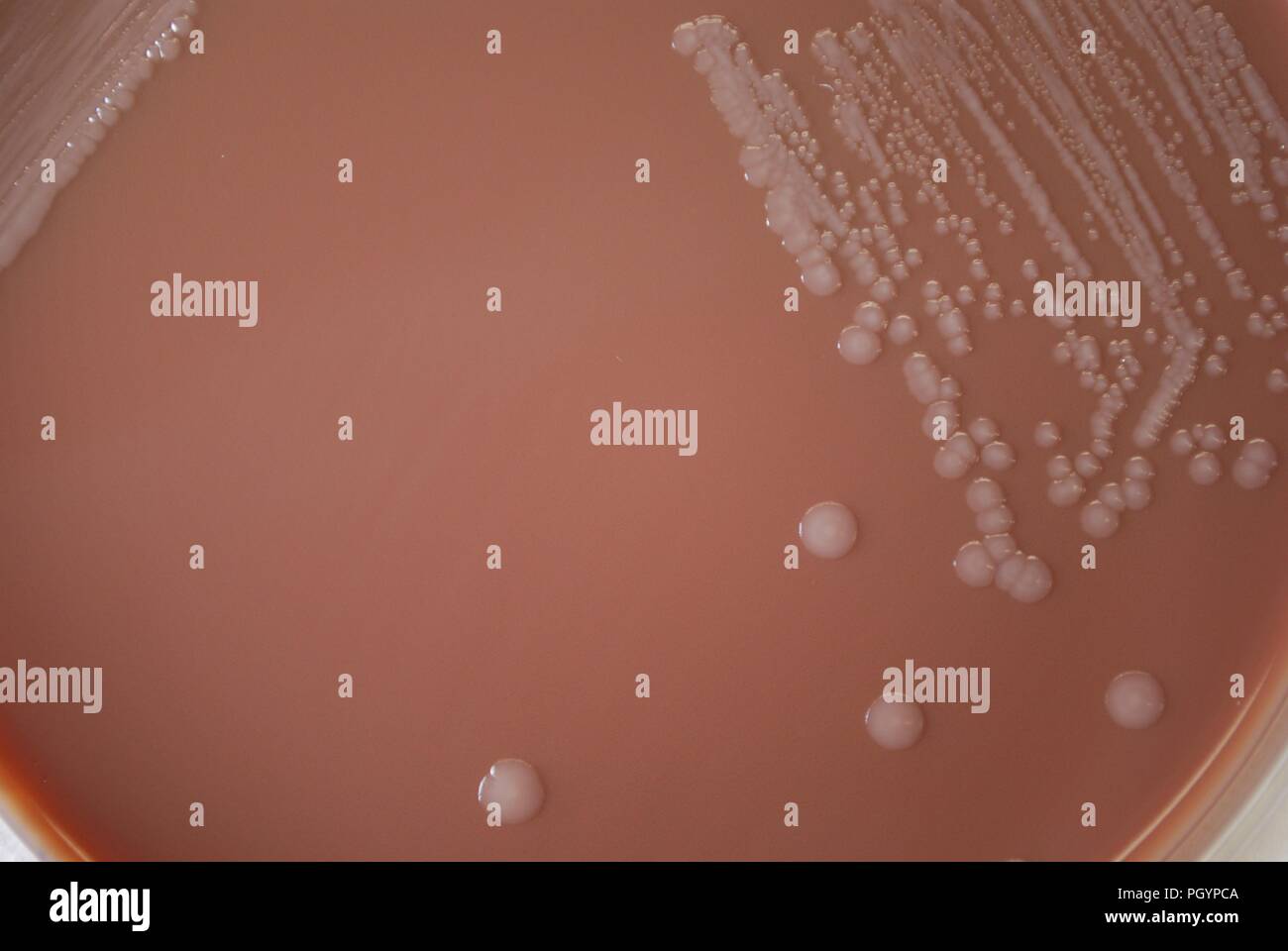 Colonial morphology of Gram-negative Yersinia pestis bacteria grown 72 hours on a medium of chocolate agar, 2010. Image courtesy Centers for Disease Control (CDC) / Dr Todd Parker, Audra Marsh. () Stock Photo