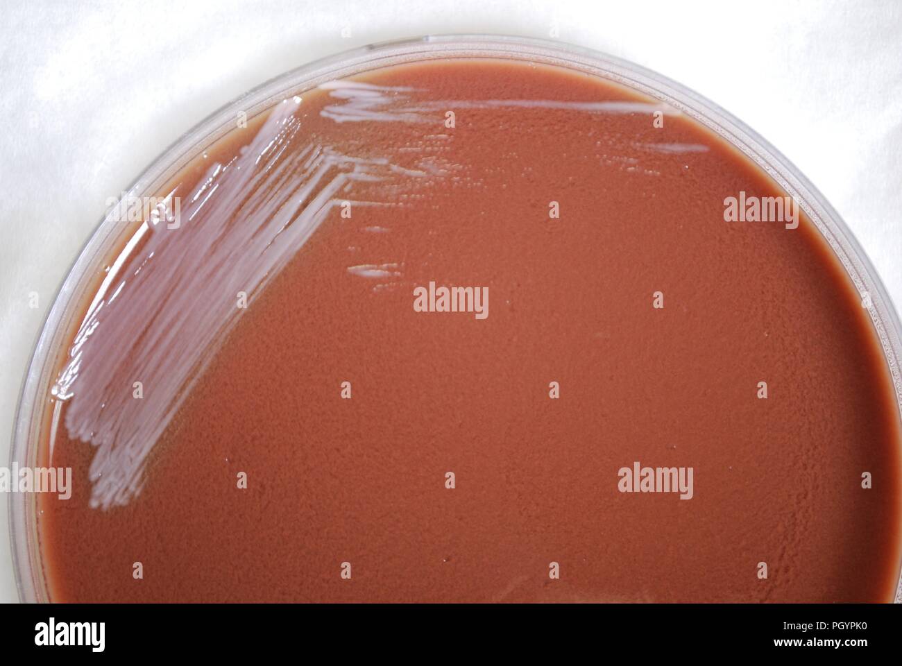 Colonial morphology of Gram-negative Burkholderia mallei bacteria grown 24 hours on a medium of chocolate agar, 2010. Image courtesy Centers for Disease Control (CDC) / Dr Todd Parker, Audra Marsh. () Stock Photo
