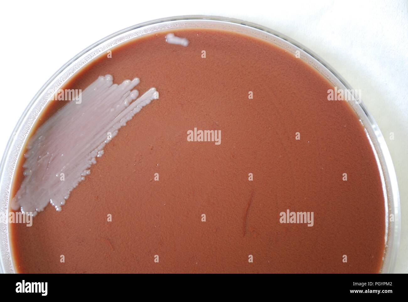 Colonial morphology of Gram-negative Burkholderia mallei bacteria grown 48 hours on a medium of chocolate agar, 2010. Image courtesy Centers for Disease Control (CDC) / Dr Todd Parker, Audra Marsh. () Stock Photo