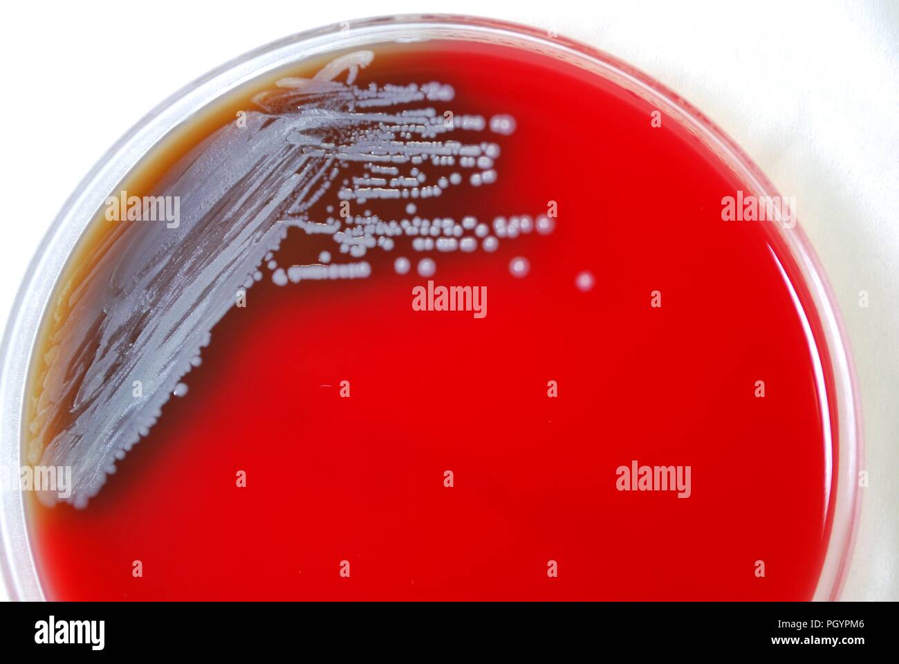 Colonial morphology of Gram-negative Burkholderia pseudomallei bacteria grown 48 hours on a medium of sheep's blood agar (SBA), 2010. Image courtesy Centers for Disease Control (CDC) / Dr Todd Parker, Audra Marsh. () Stock Photo