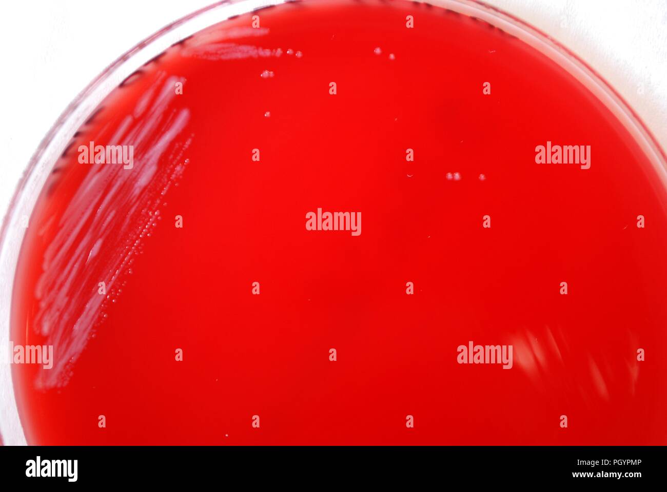 Colonial morphology of Gram-negative Yersinia pestis bacteria grown 48 hours on a medium of sheep's blood agar (SBA), 2010. Image courtesy Centers for Disease Control (CDC) / Dr Todd Parker, Audra Marsh. () Stock Photo