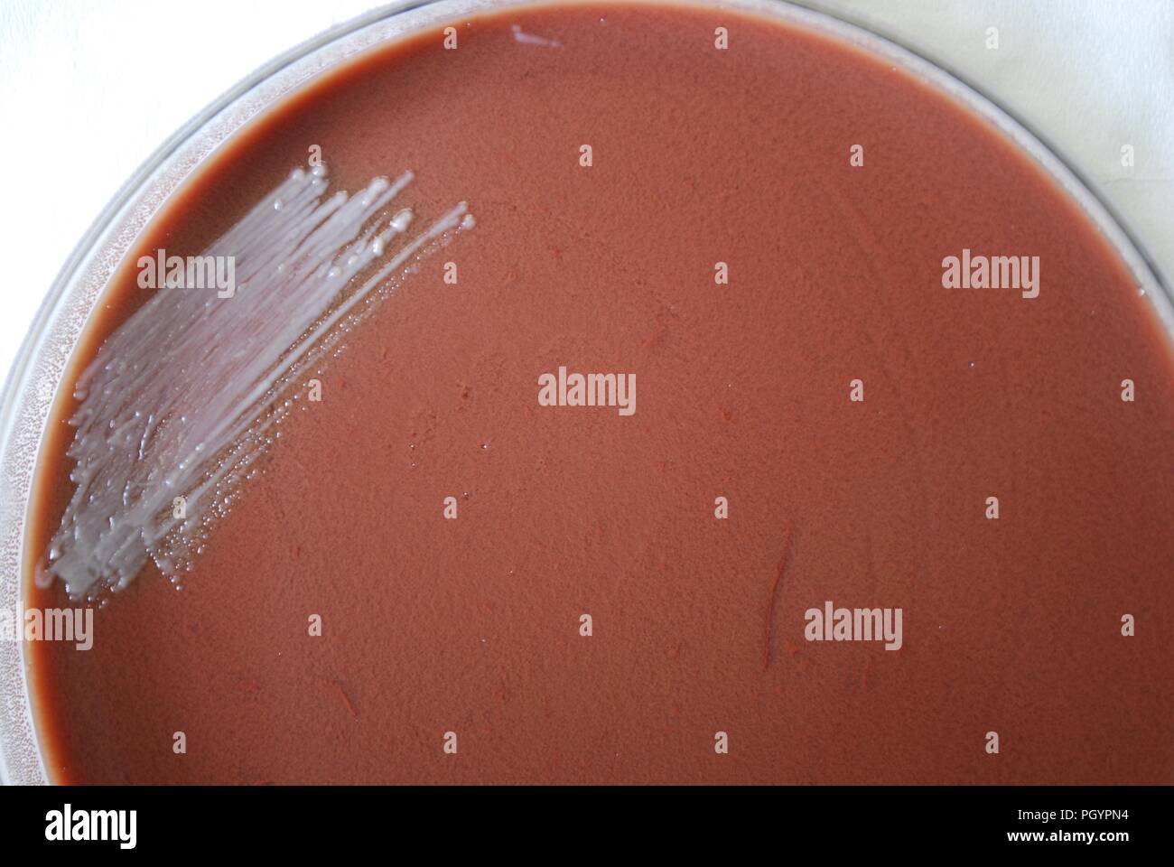 Colonial morphology of Gram-negative Francisella tularensis bacteria grown 24 hours on a medium of cysteine heart infusion agar (CHAB), 2010. Image courtesy Centers for Disease Control (CDC) / Dr Todd Parker, Audra Marsh. () Stock Photo