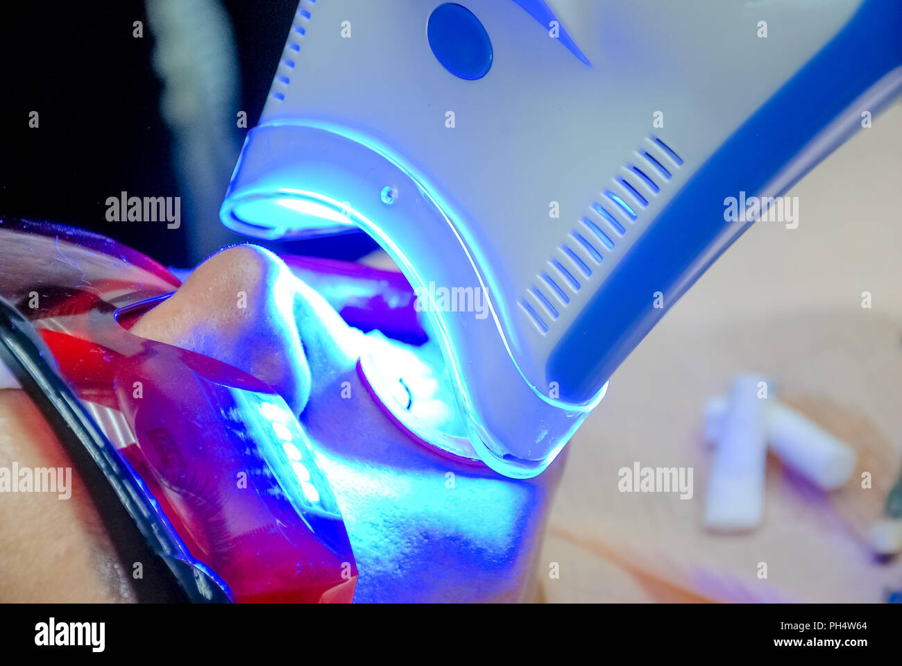 Dental Uv Light High Resolution Stock Photography and Images Alamy