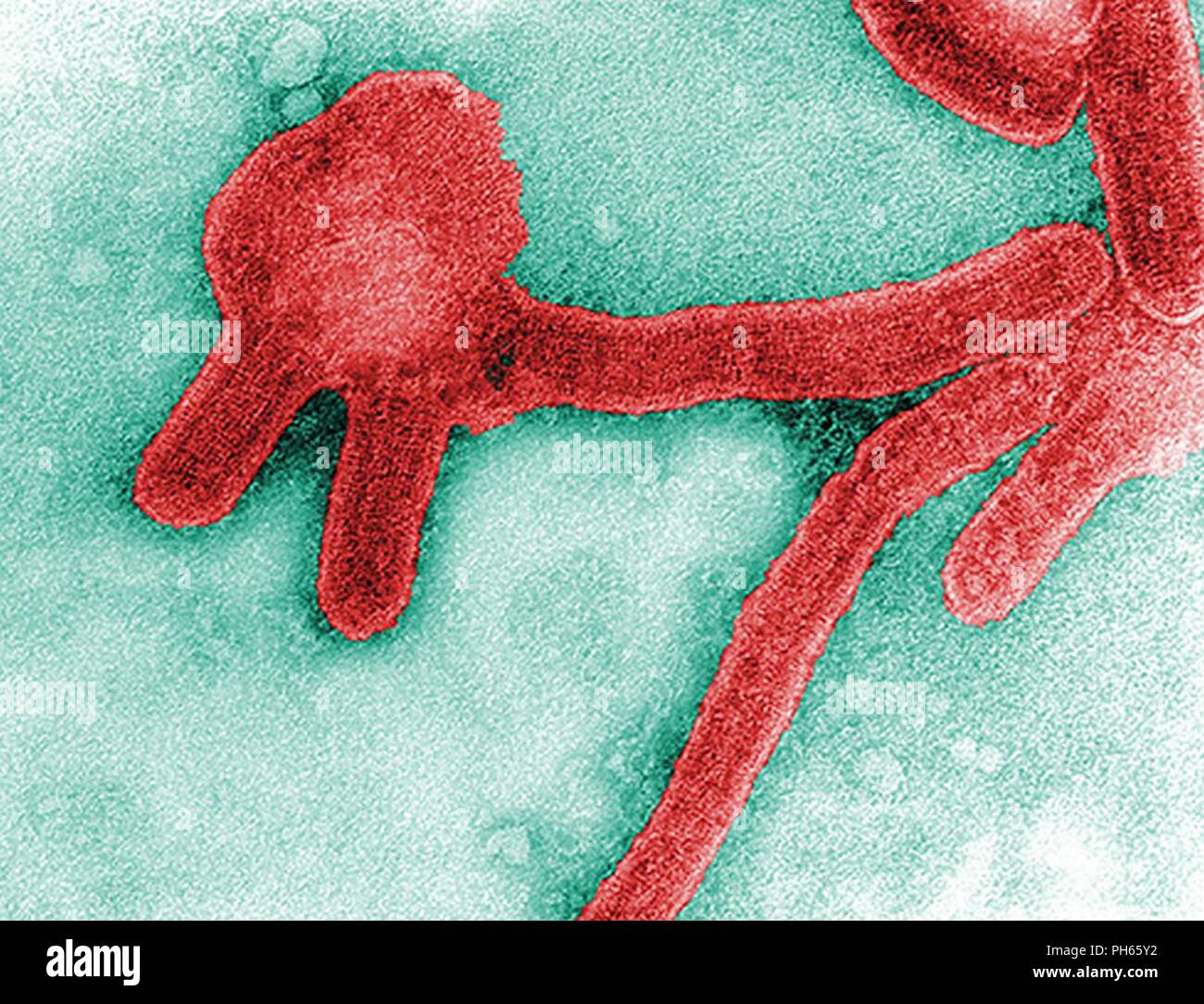 1968  F. A. Murphy; Cynthia Goldsmith    This colorized negative stained transmission electron micrograph (TEM), captured by F.A. Murphy in 1968, depicts a number of Marburg virus virions, which had been grown in an environment of tissue culture cells. Marburg hemorrhagic fever is a rare, severe type of hemorrhagic fever which affects both humans and non-human primates. Caused by a genetically unique zoonotic (that is, animal-borne) RNA virus of the filovirus family, its recognition led to the creation of this virus family. The four species of Ebola virus are the only other known members of th Stock Photo