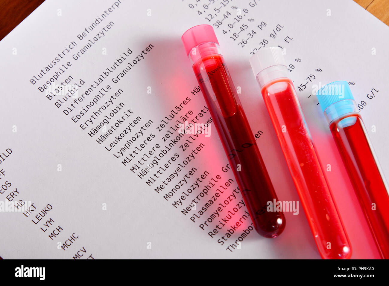 Lab blood test laboratory medicine Stock Photo Alamy