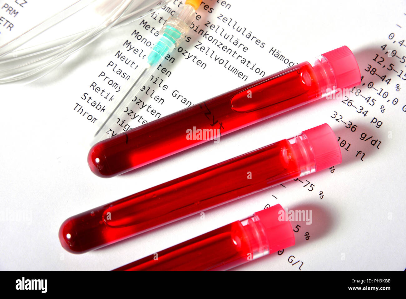 Lab blood test laboratory medicine Stock Photo Alamy