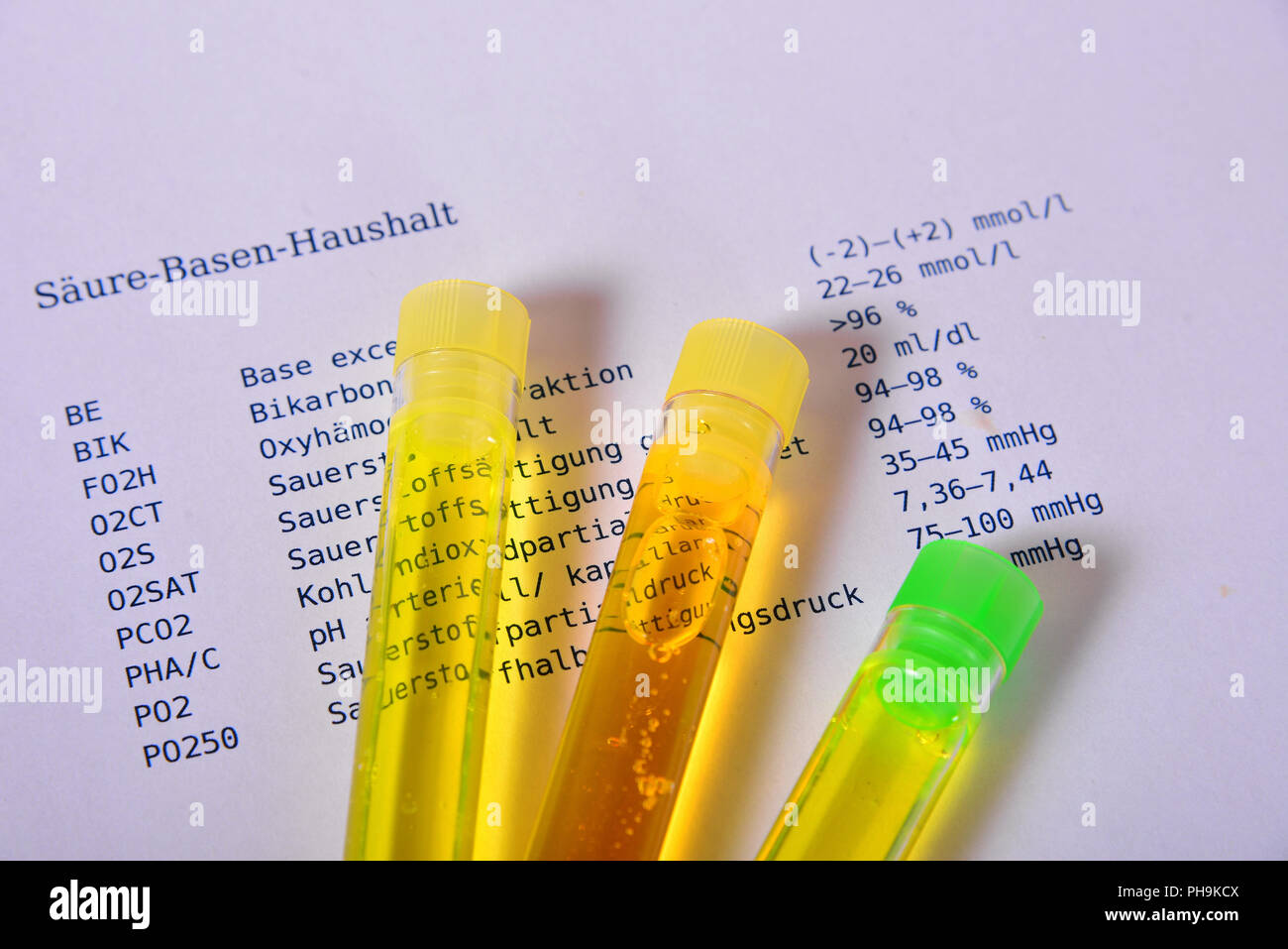 Urine test laboratory urine Stock Photo Alamy