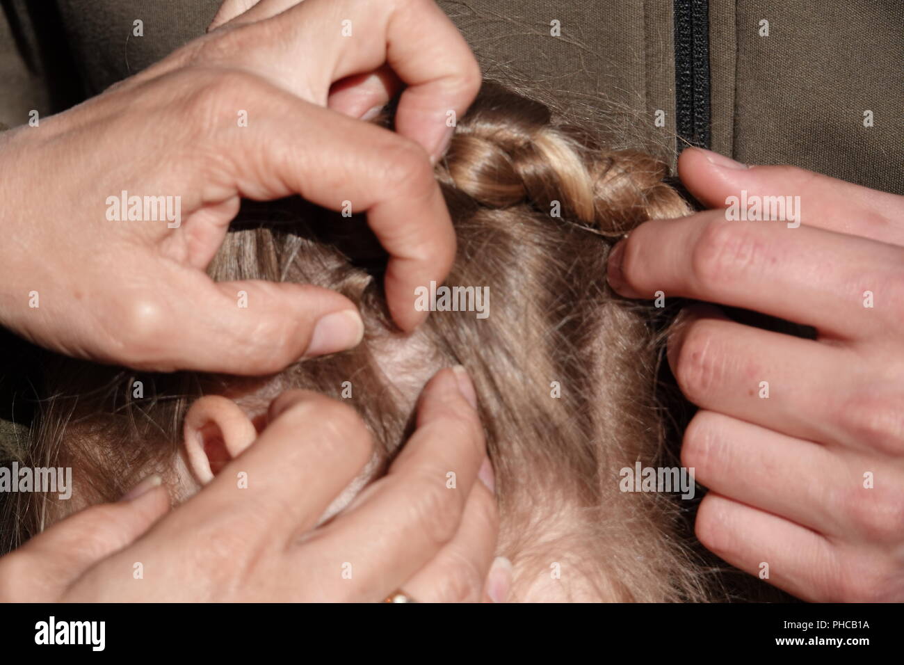 Head Lice Infection Common In Young People Hair Being Checked