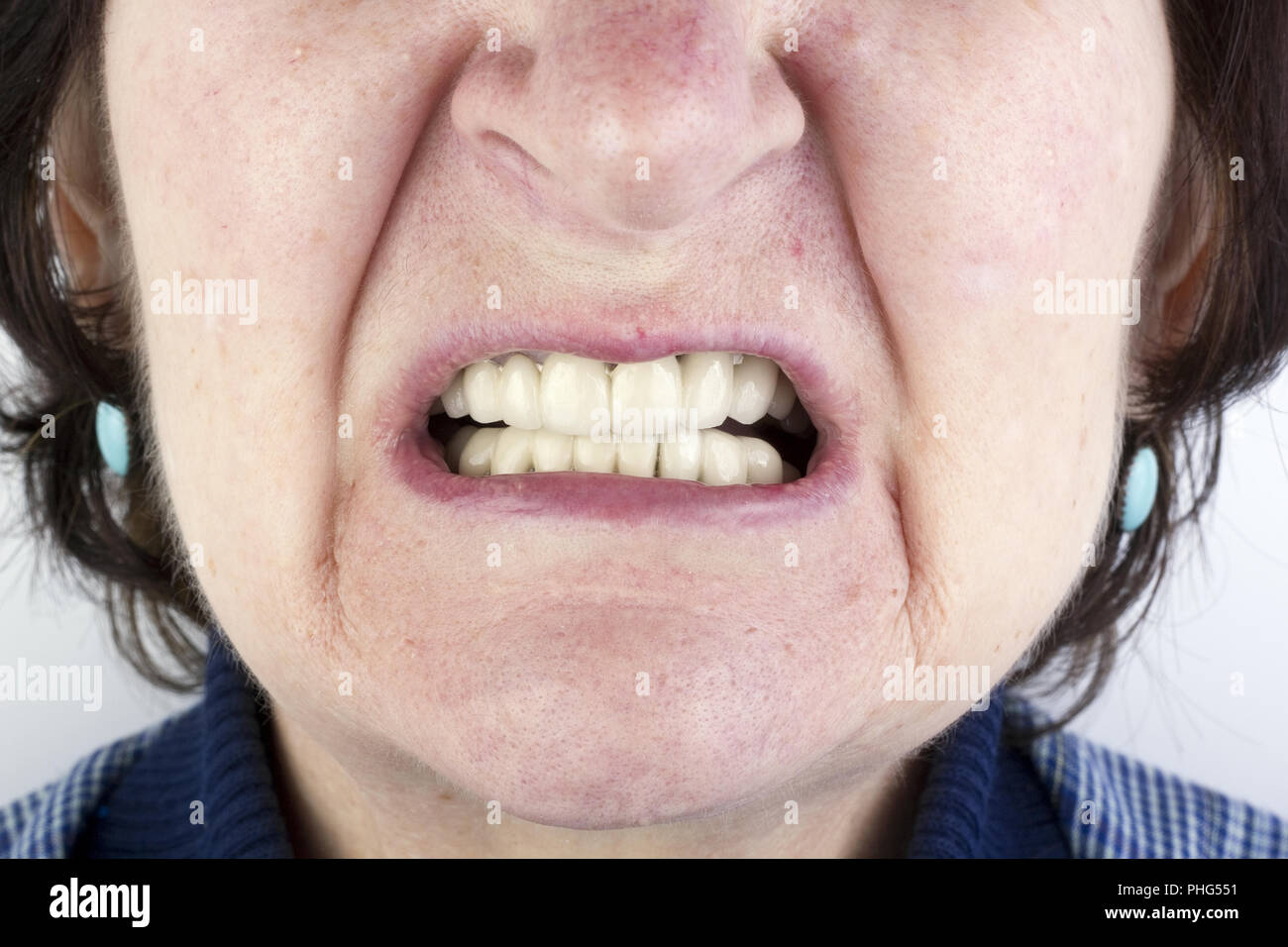 Elderly woman with new ceramic dentures Stock Photo