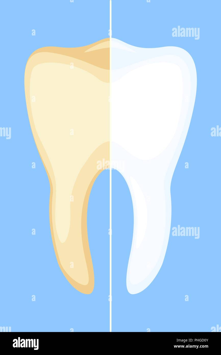 Teeth whitening concept. Stock Vector