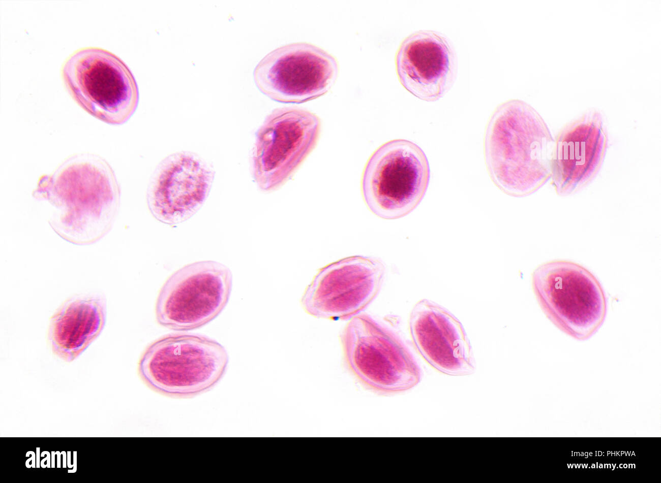 Microscope photography. Ascaris lumbricoides eggs. Stock Photo