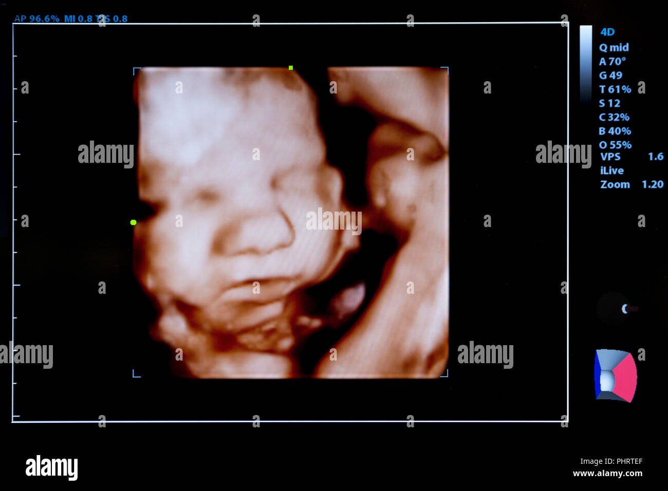 Ultra sound baby fotografías e imágenes de alta resolución - Alamy