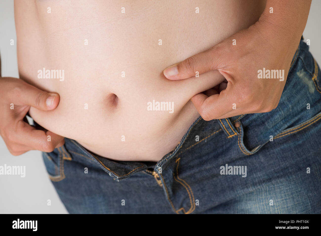 Woman grabbing skin on her flanks with black color crosses marking, Lose  weight and liposuction cellulite removal concept, Isolated on white  backgroun Stock Photo - Alamy