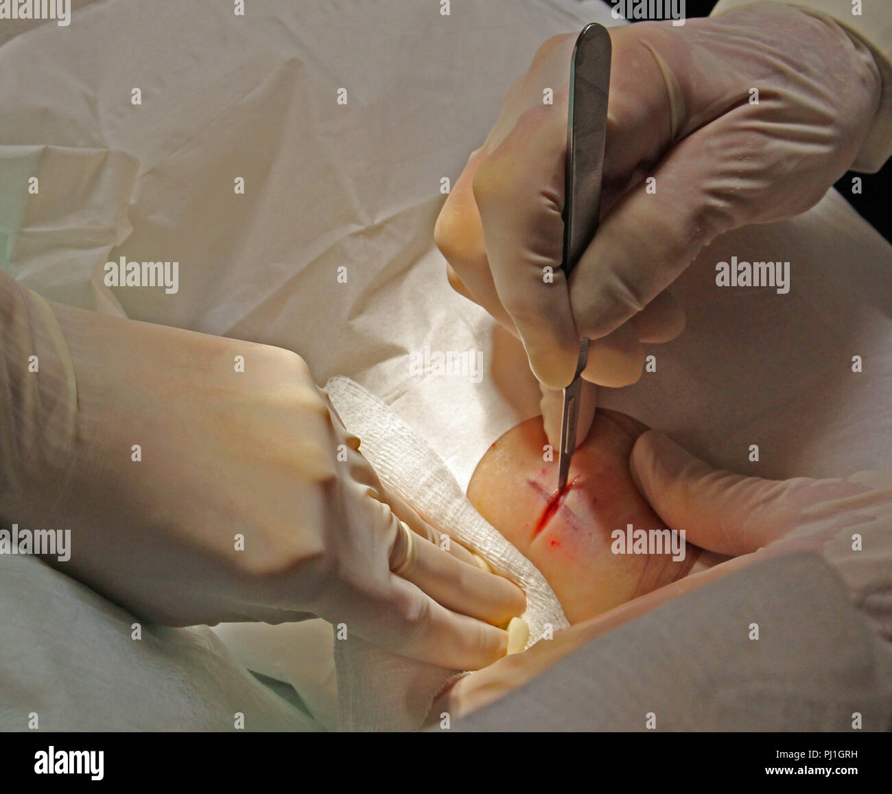 Making a surgical incision Stock Photo