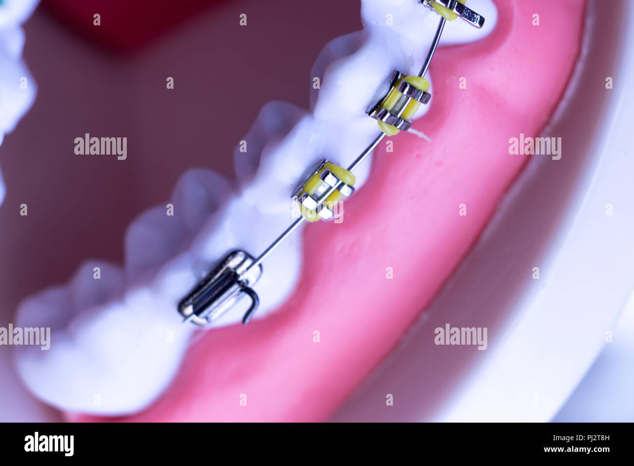 Dental metal braces teeth retainer aligners teaching orthodontics model