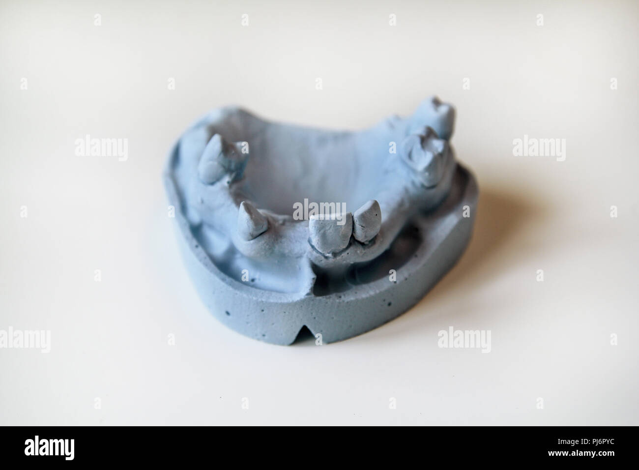 Plaster model of the jaws. Dentures and dentistry. Dental prosthesis