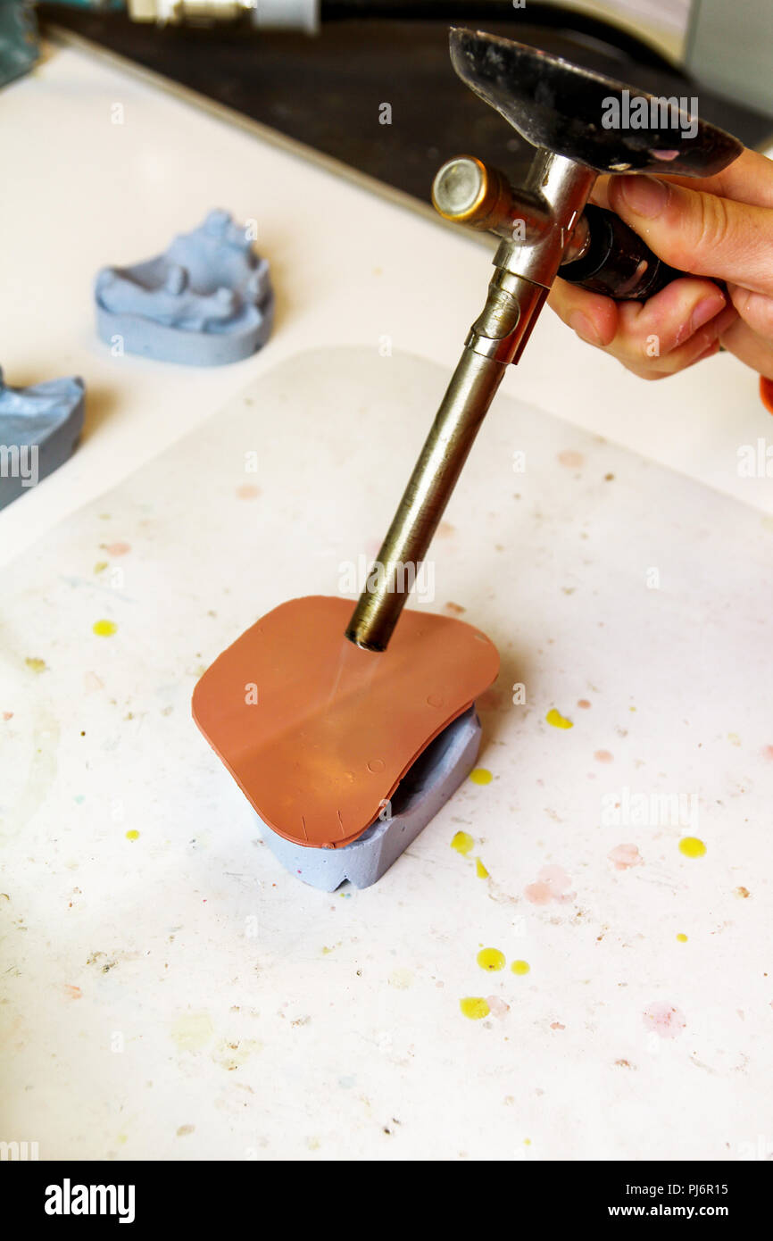 Warming of Shellac base plates. Dentures. Dental prosthesis, dentures