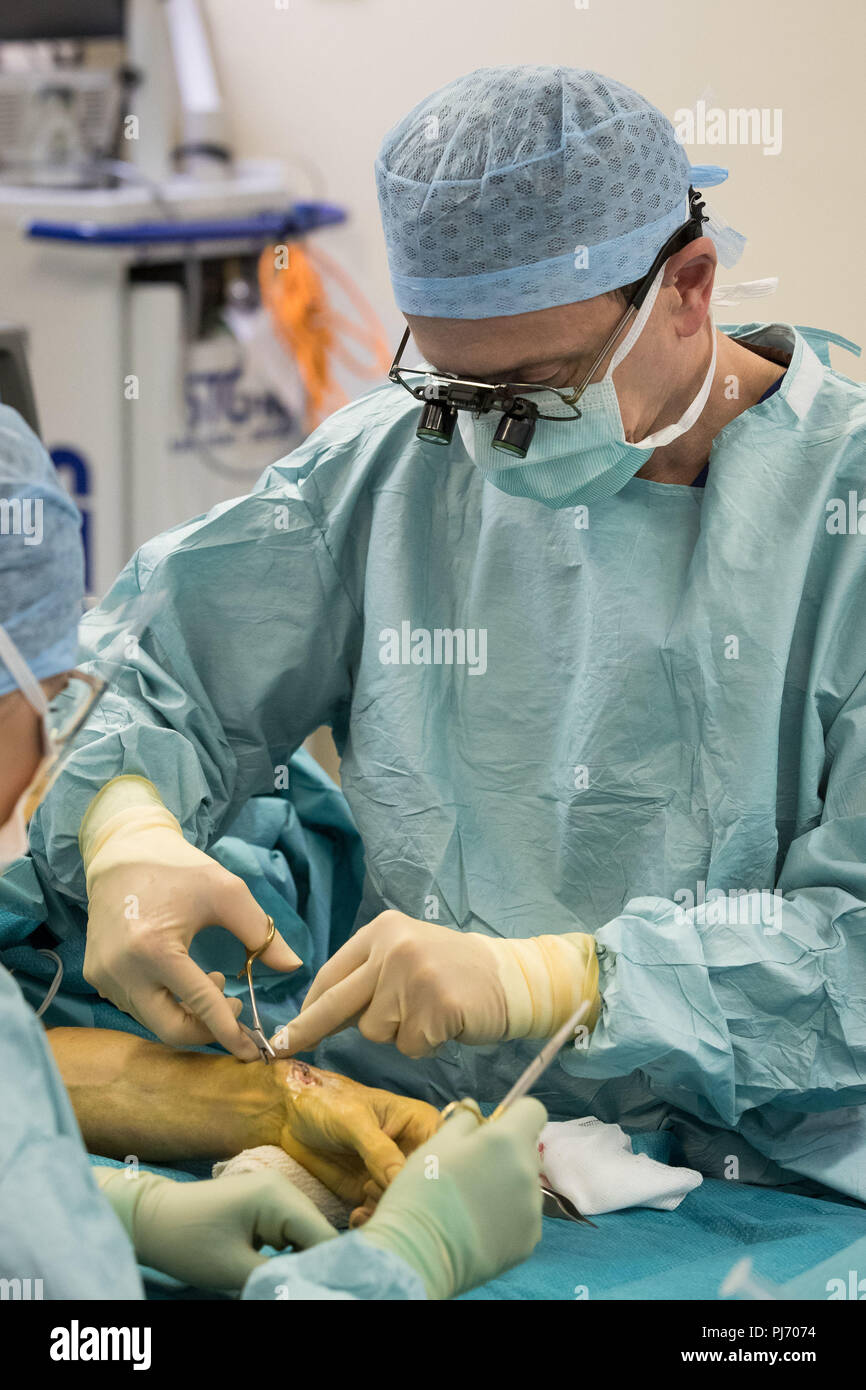 Carlos Heras-Palou, 53, performing hand surgery at Derby Nuffield Hospital. Mr Heras-Palou, an orthopaedic specialist surgeon, may have had his career saved by a new drug called 'Patisiran'. The rare disease, hereditary transthyretin-mediated amyloidosis (hATTR amyloidosis), progressed and destroyed the nerves in his hands, rendering them useless. However after an 18 month course of Patisiran the condition has halted and reversed. Stock Photo
