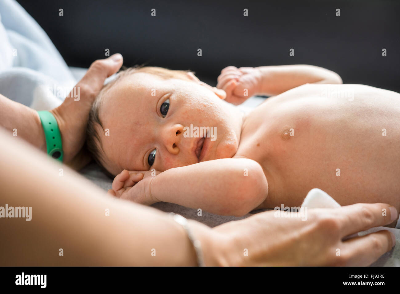Newborn baby boy face with many  pimples on his face assisted by his mother Stock Photo