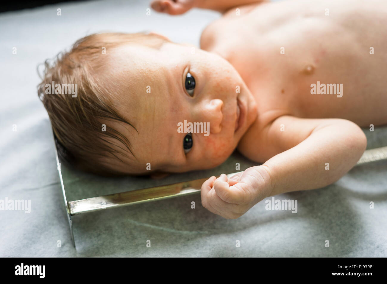 Newborn baby boy with many pimples whose growth is measured Stock Photo