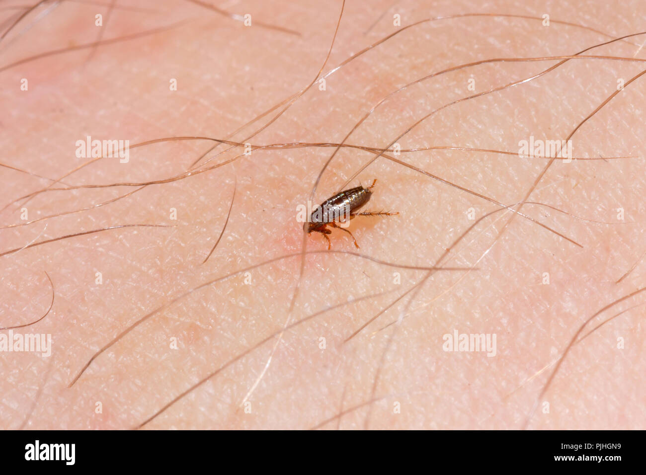 Human Flea High Resolution Stock Photography And Images Alamy Human Flea High Resolution Stock Photography And Images Alamy